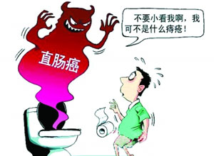 直肠癌的早期症状